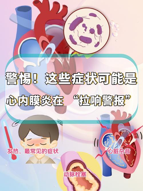 亚急性风湿性心内膜炎