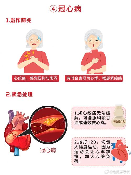 比较心梗脑梗溶栓区别