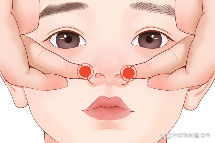 感冒流鼻涕扎什么穴位