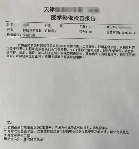 多次脑梗 诊断 书写