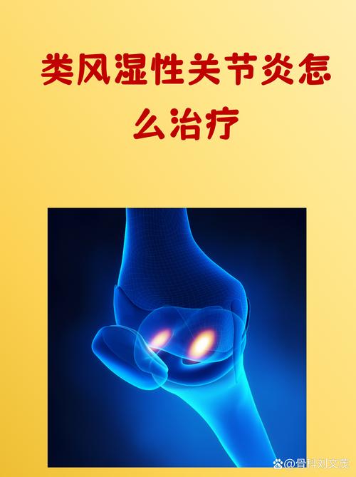 风湿性关节炎多久会死