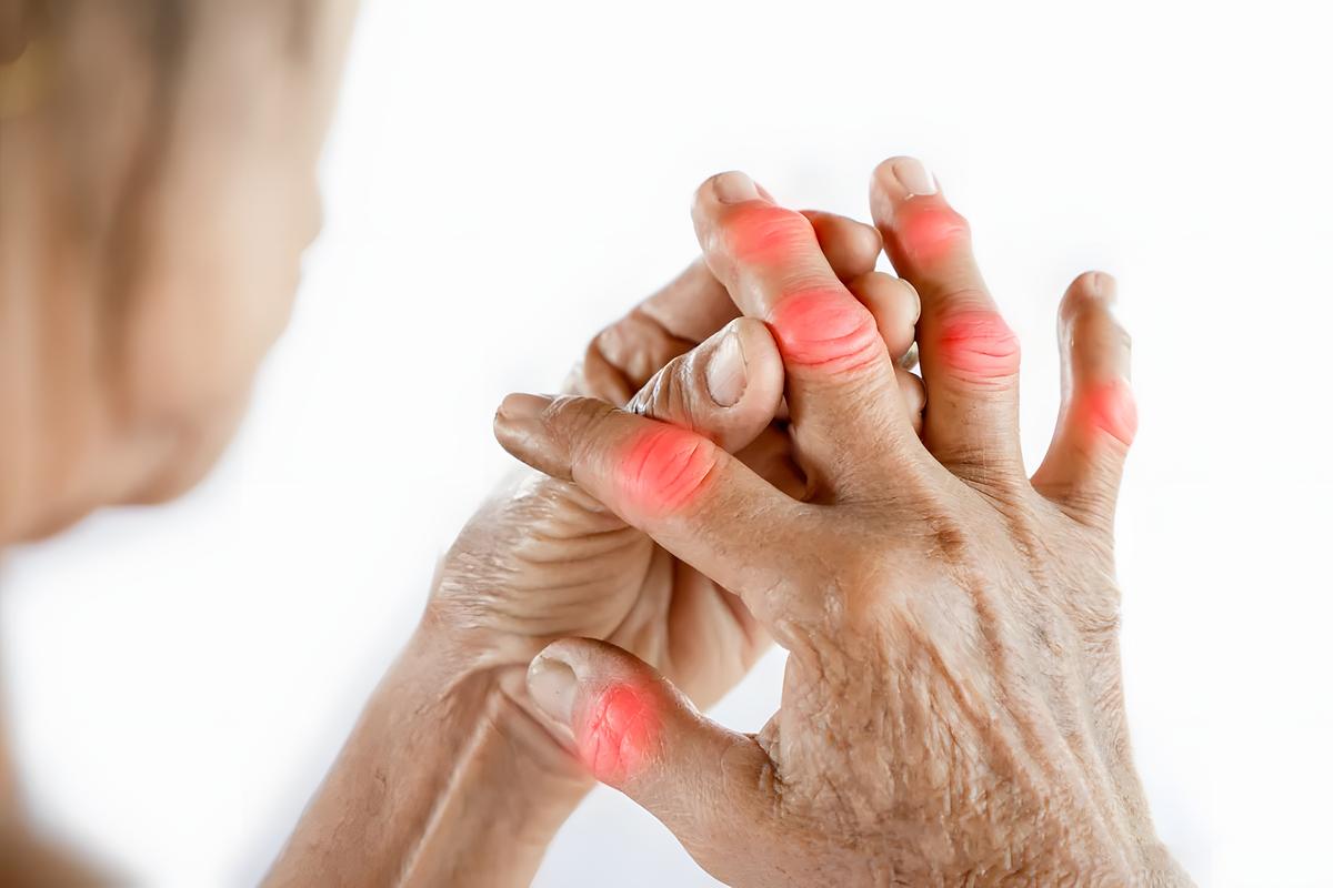 风湿性关节炎常用药物