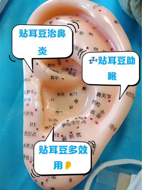 失眠耳穴压豆常用穴位