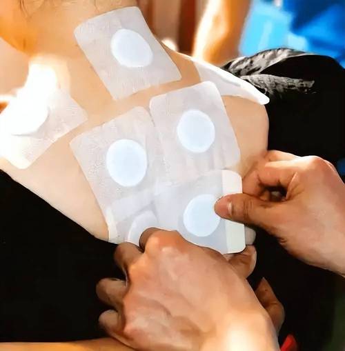 发烧艾灸贴贴什么穴位