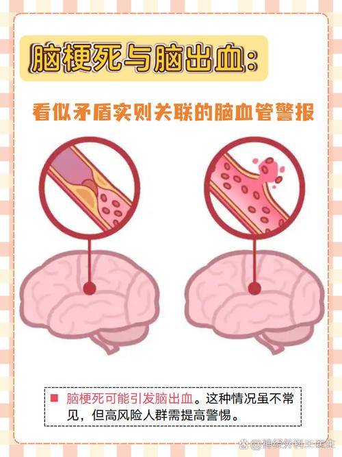 脑供血不足和脑梗关联