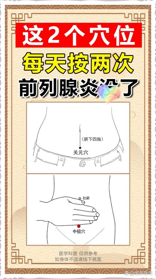 治疗前列腺增生的穴位