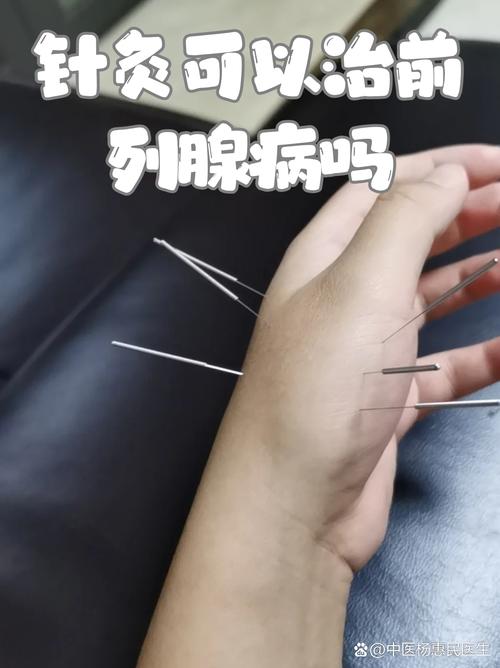 治疗前列腺增生的穴位