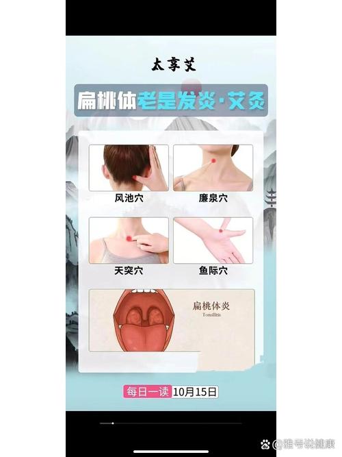 扁桃体发炎按那个穴位