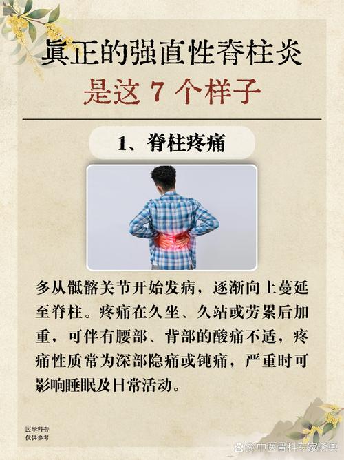 强直性脊柱炎跟类风湿