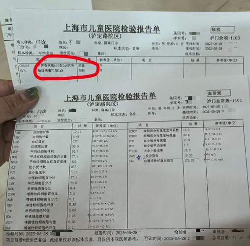 幼儿风湿性关节炎确诊