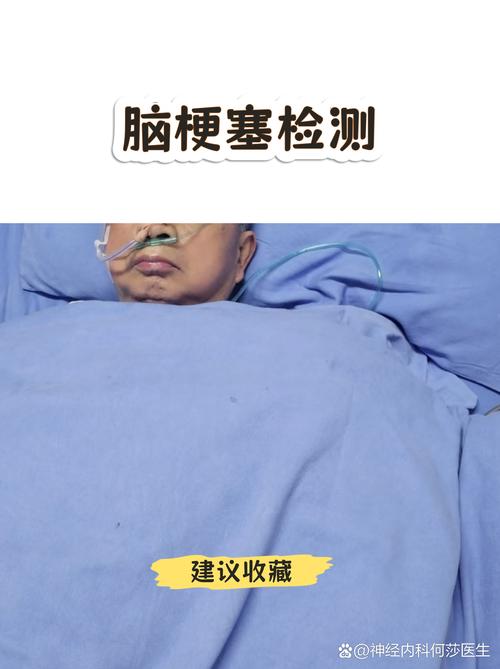 脑ct正常可能脑梗吗