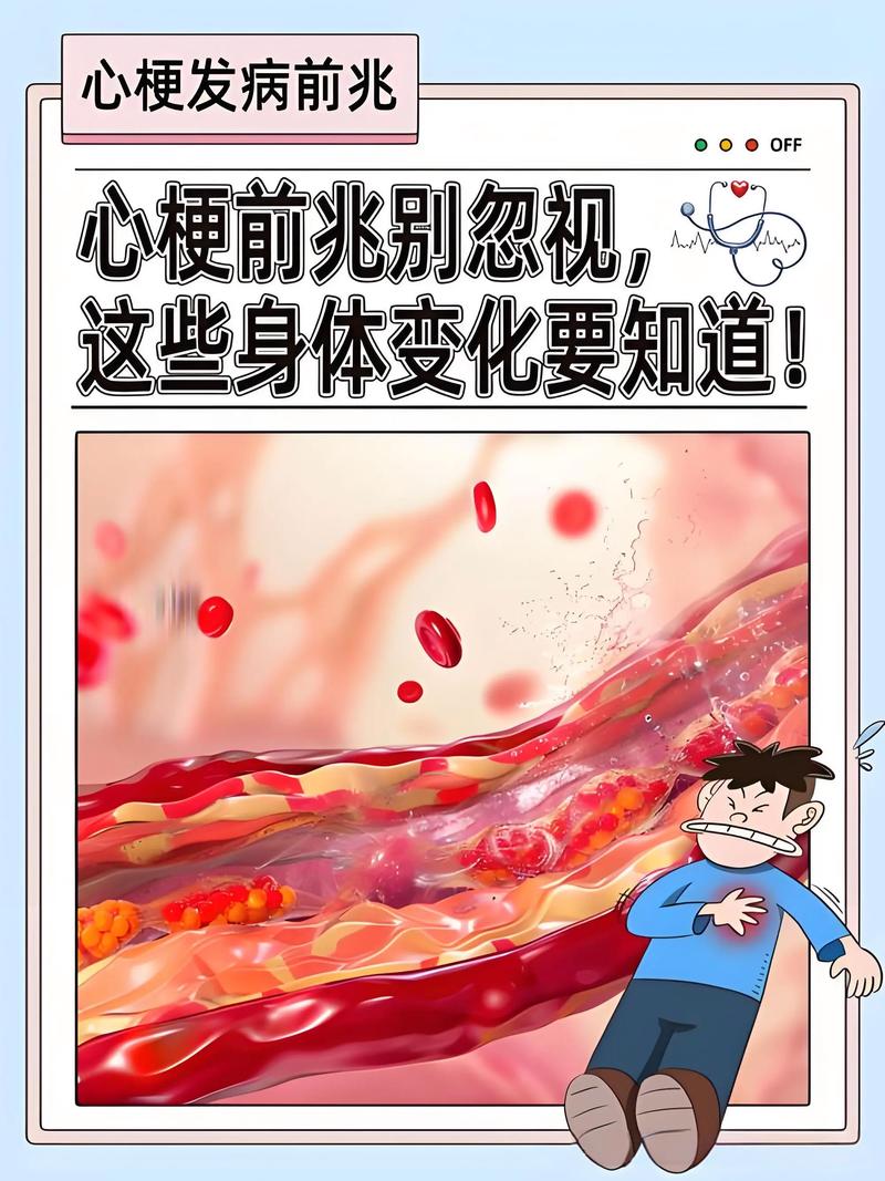 脑梗心梗怎么预防复发