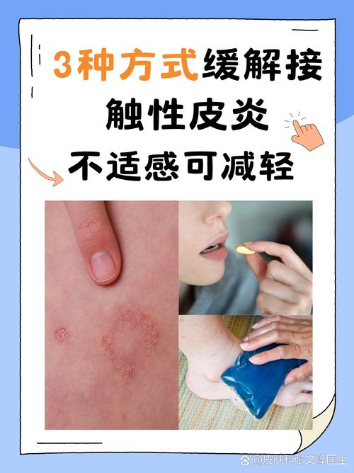 长效青霉素预防风湿热