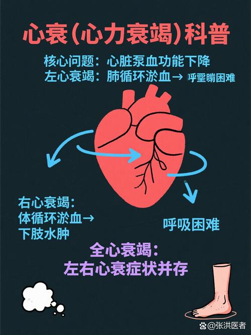心肺功能衰竭心梗脑梗
