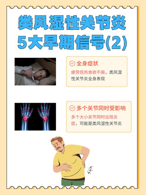 类风湿关节炎是什么科