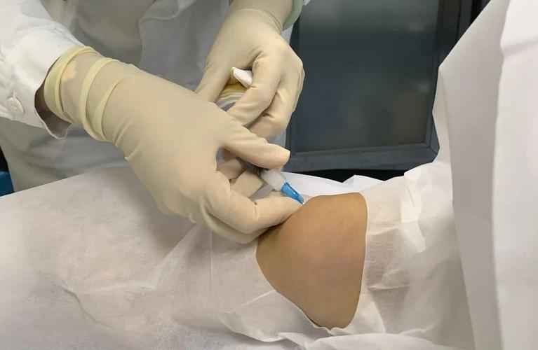 风湿性关节炎打针治疗