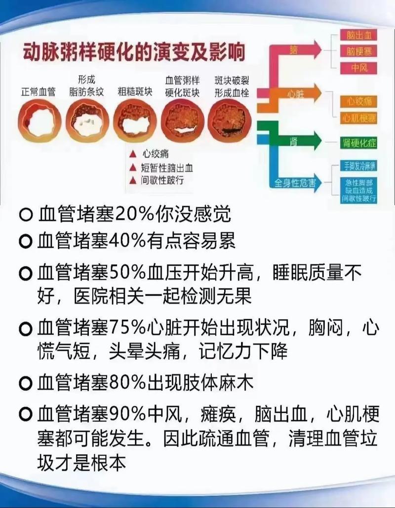 心梗脑梗应该怎样预防