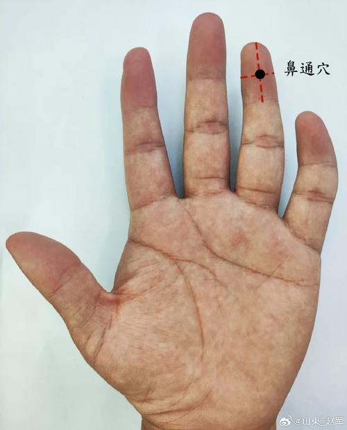 治疗鼻子不通的穴位