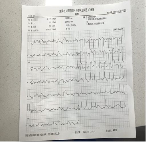 脑梗心梗尼莫地平病例