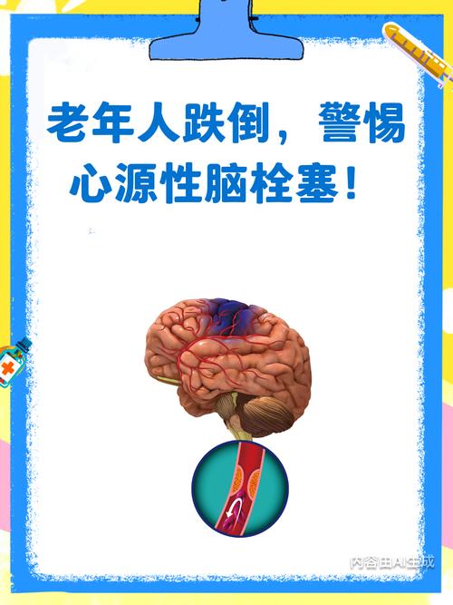 心梗之后 脑梗 溶栓