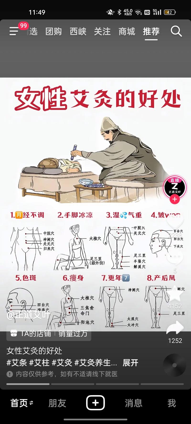 风湿性关节炎怎样艾灸