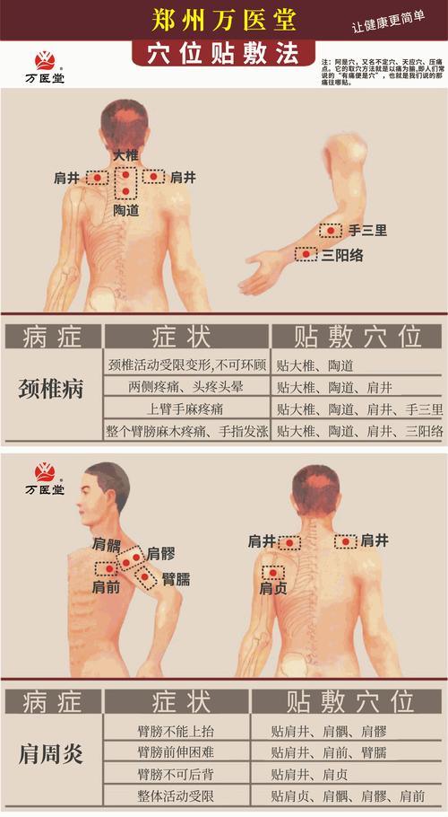 中药敷贴的常用穴位