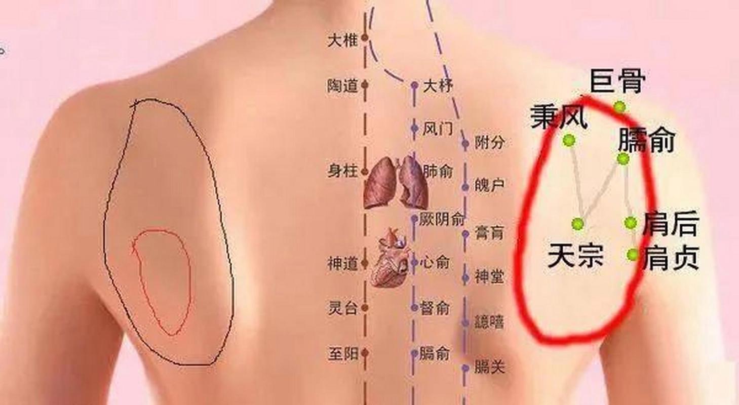 肩周炎与对应穴位图