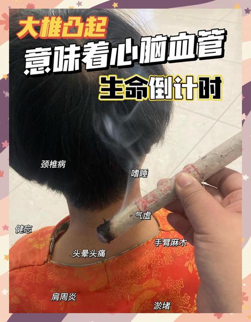 治疗颈椎关键的穴位