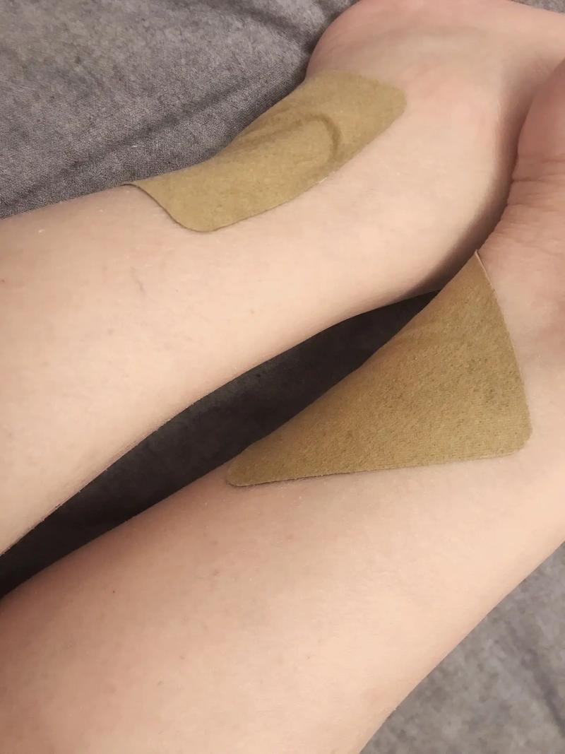 风湿贴膏药后火辣辣的