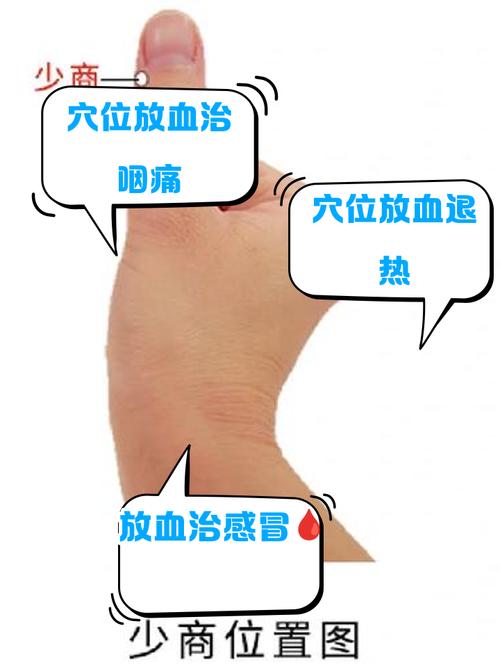 穴位放血疗法的禁忌