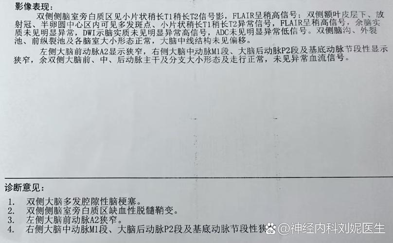 心梗脑梗发光检查项目
