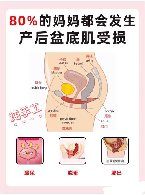脑梗小便失禁梗的部位