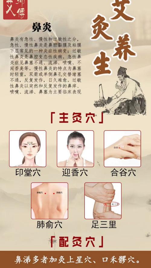鼻炎哪个特效穴位图