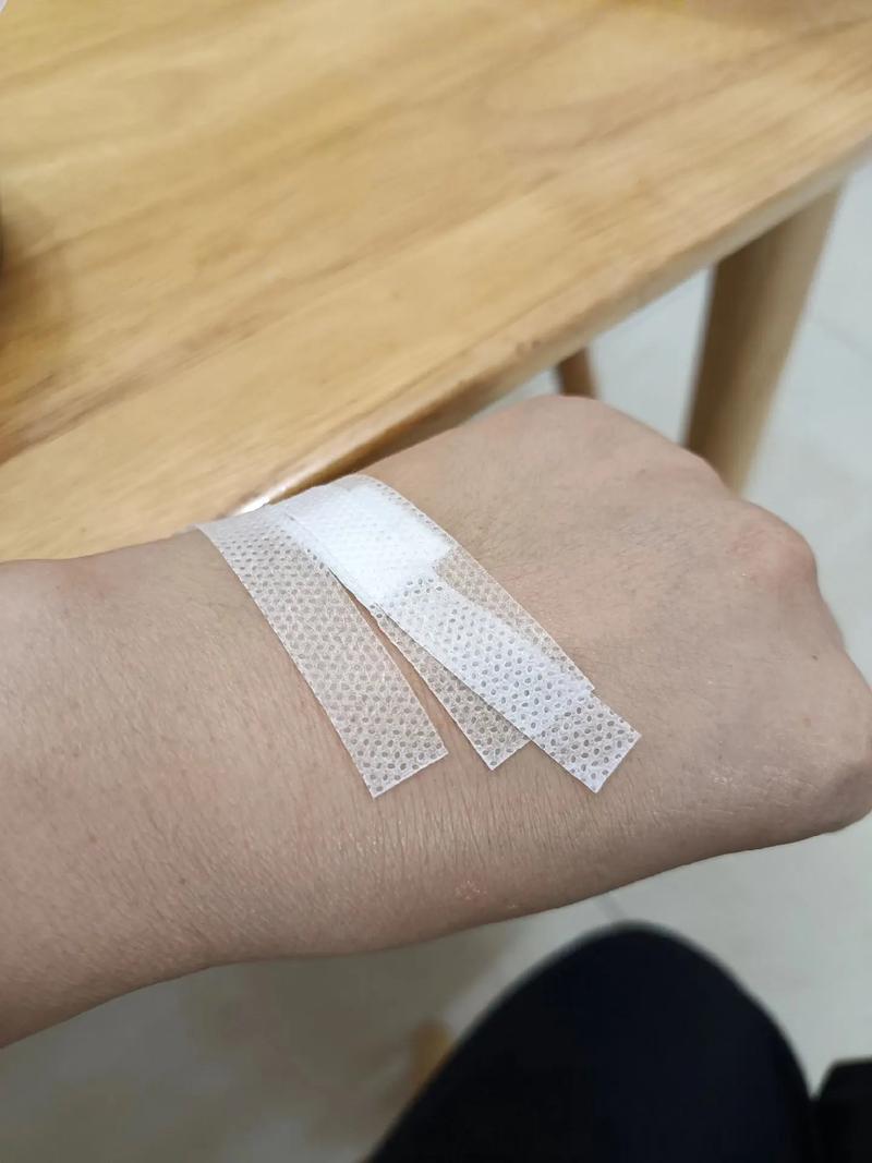 手臂贴了穴位贴流水