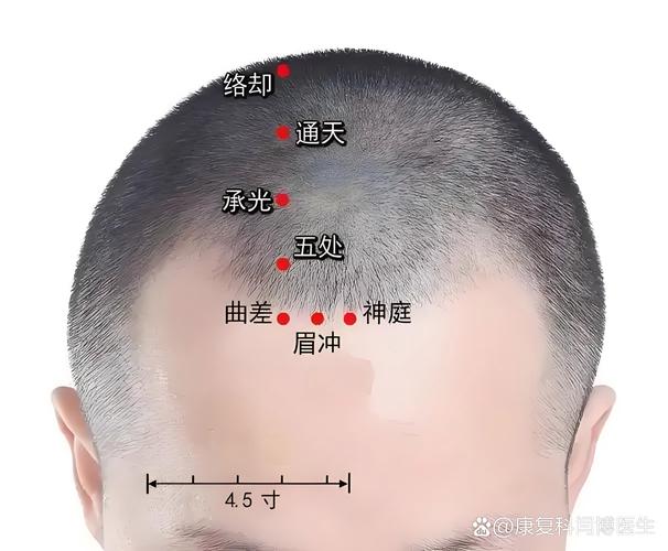 额窦炎按摩哪些穴位