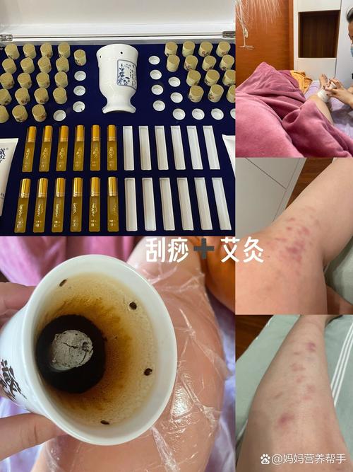 人流产后风湿病怎么治