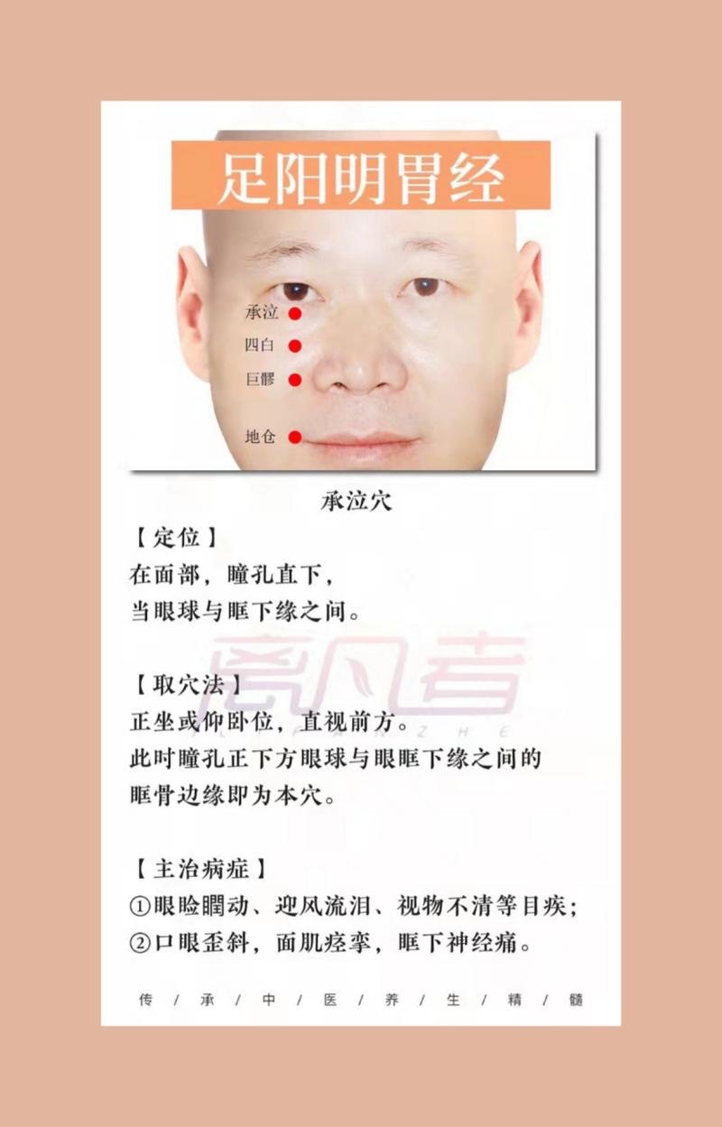 如何确认承泣穴位置