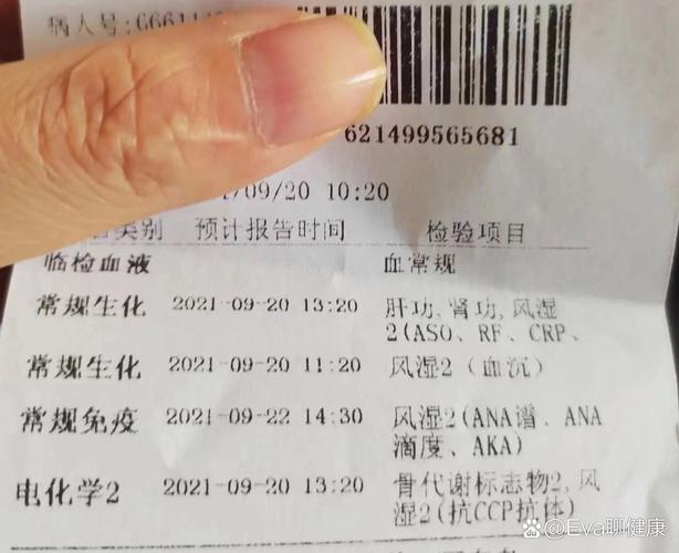 风湿四项是检查什么的