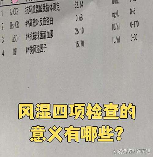 风湿四项是检查什么的
