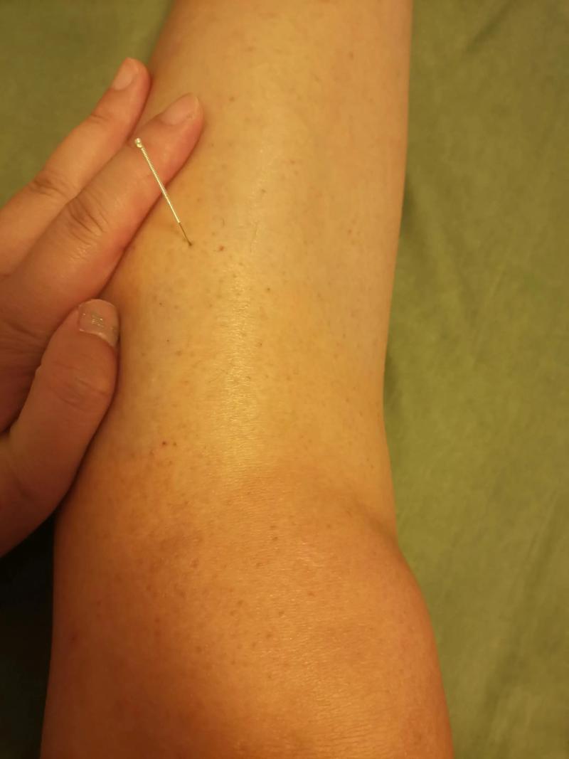 骨刺脚后跟针灸穴位