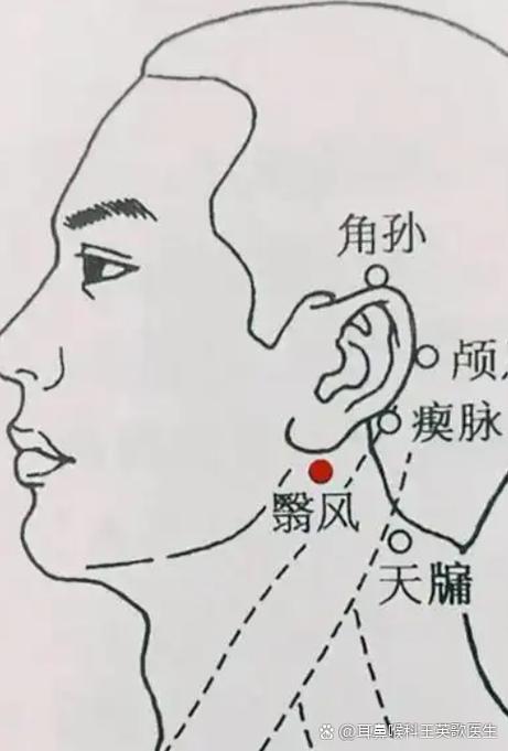 治耳鸣针刺那个穴位