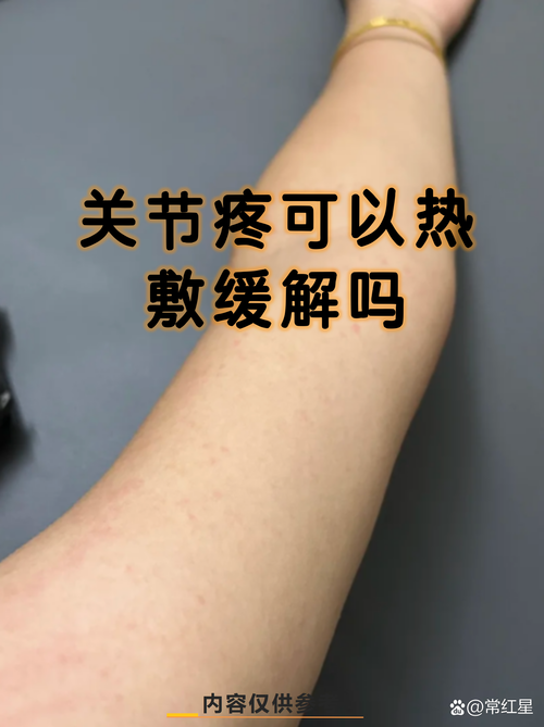 风湿性舞蹈病能自愈吗