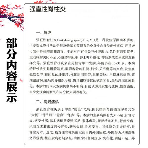 干燥综合症是类风湿吗