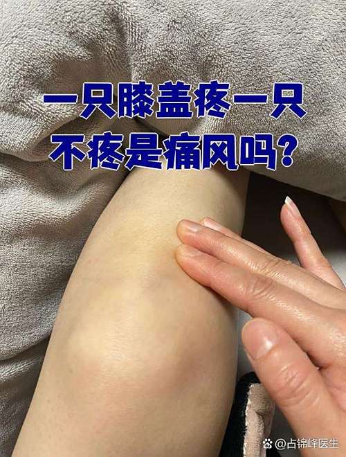 整条腿都疼像风湿一样