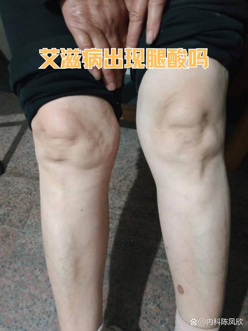 整条腿都疼像风湿一样