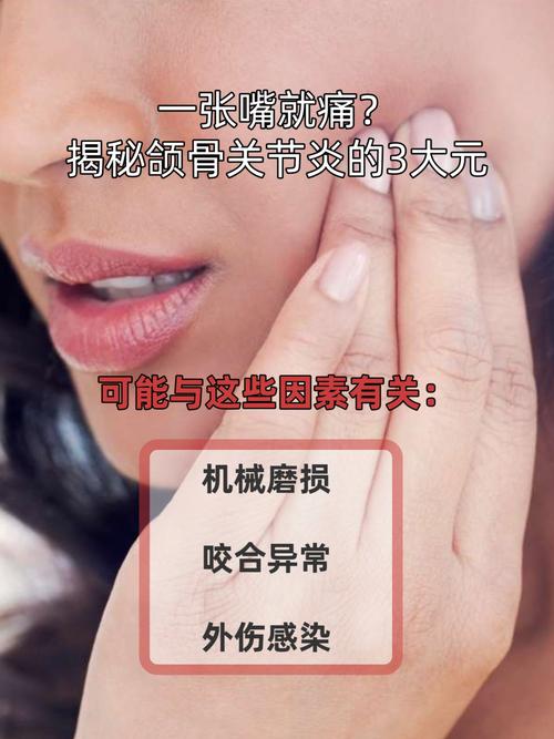 颞颌关节类风湿关节炎