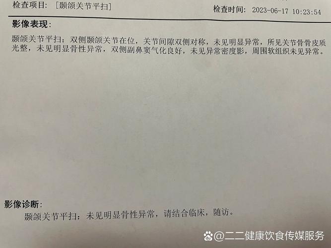 颞颌关节类风湿关节炎