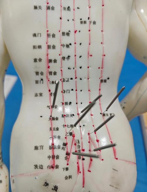 腰部可以针灸的穴位