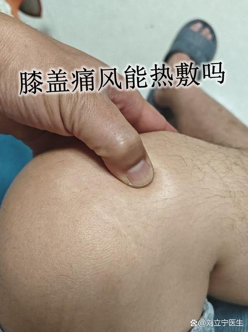 风湿膝关节痛怎么治疗