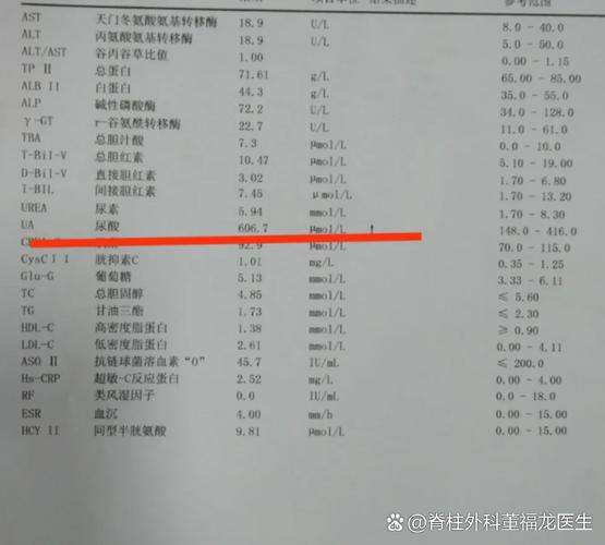 风湿四项检查有什么用